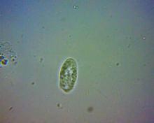 Paramecium from Hay Infusion.